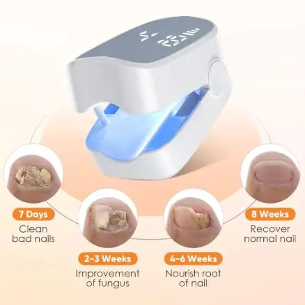 Nail fungus laser device